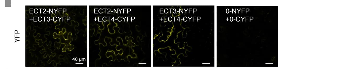 Open access visualization of Microscopy, BiFC Assay, Protein-Protein Interaction, Nicotiana benthamiana, YFP Fluorescence