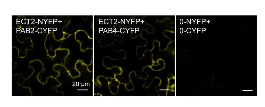 Open access visualization of Microscopy, BiFC Assay, ECT2, PAB2, PAB4