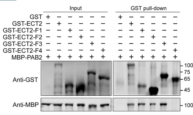 Open access visualization of Gel, Pull-down Assay, PAB2, PrLD Domain, ECT2