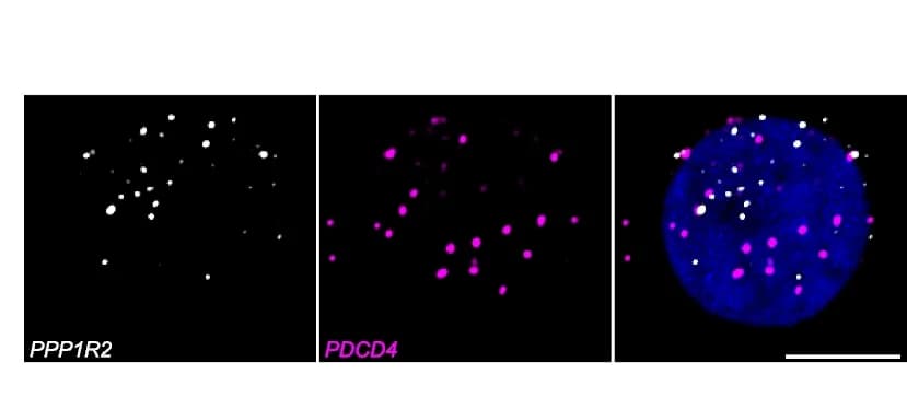 Open access visualization of Microscopy, PDCD4, PPP1R2, smFISH, CD8 Naive T Cells