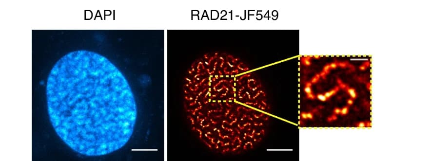 Open access visualization of Microscopy, Super-resolution Images, HeLa Cells, RAD21, Vermicelli