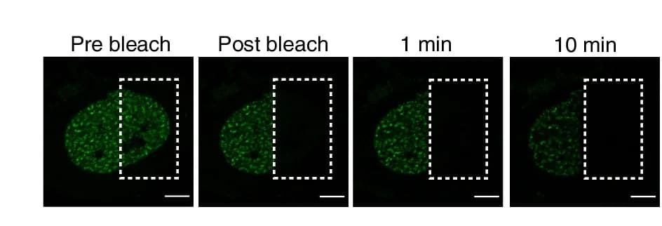 Open access visualization of Microscopy, Photo, Inverse Fluorescence Recovery After Photobleaching Assay, RAD21, HeLa Cells