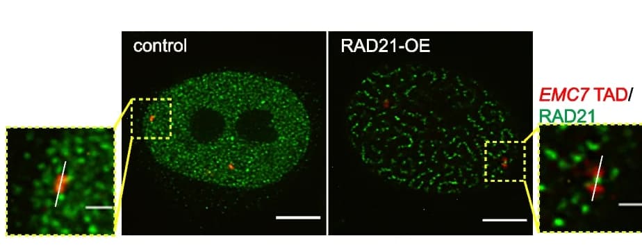 Open access visualization of Microscopy, Super-resolution images, EMC7 TAD, RAD21, In situ hybridization