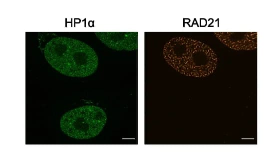 Open access visualization of Microscopy, Immunofluorescence, Control Cells, RAD21 Over-expression, HeLa Cells