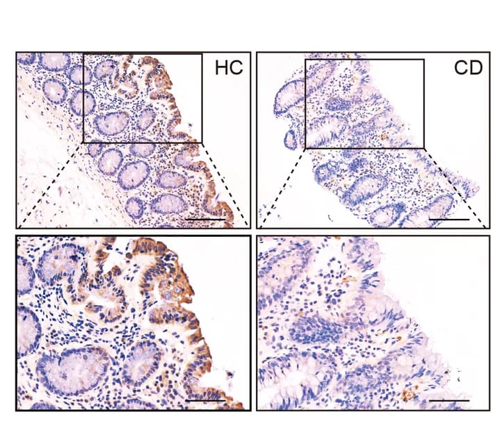 Open access visualization of Microscopy, Colonic Epithelium, Crohn's Disease Patients, Healthy Controls, PCDH20