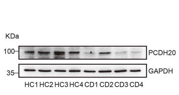 Open access visualization of Gel, Immunoblots, PCDH20 Protein, Colonic Mucosa, Crohn's Disease Patients