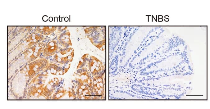 Open access visualization of Microscopy, Photo, Immunohistochemistry, PCDH20 levels, Colonic Epithelium
