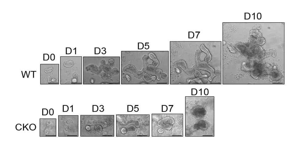 Open access visualization of Microscopy, Intestinal Organoid, Pcdh20 CKO Mice, Wild-Type Mice