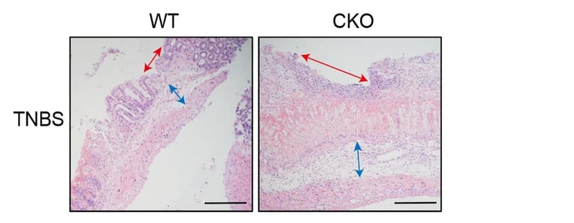 Open access visualization of Microscopy, Ulcers, Edema, Pcdh20 CKO mice, WT mice
