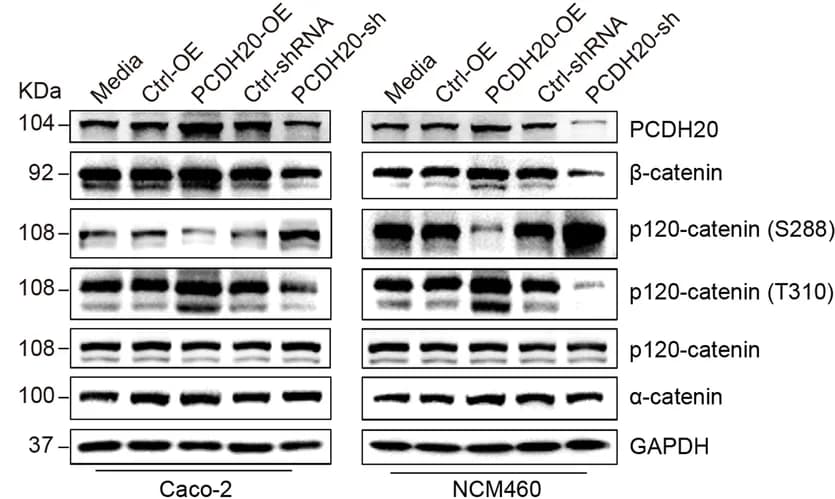 Open access visualization of Gel, Immunoblots, Adherens Junctions Components, Cell Lines, PCDH20 Knockdown