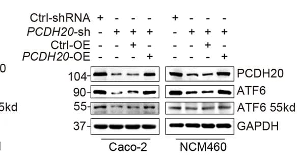Open access visualization of Gel, Immunoblot, ATF6 expression, PCDH20-deficient Caco-2 cell line, PCDH20 overexpression plasmid