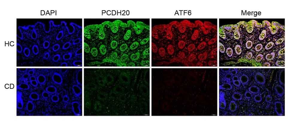 Open access visualization of Microscopy, ATF6 expression, PCDH20-deficient CD patients, Immunofluorescence