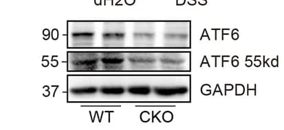 Open access visualization of Gel, ATF6 expression, Pcdh20 CKO mice, DSS-induced colitis, WT mice