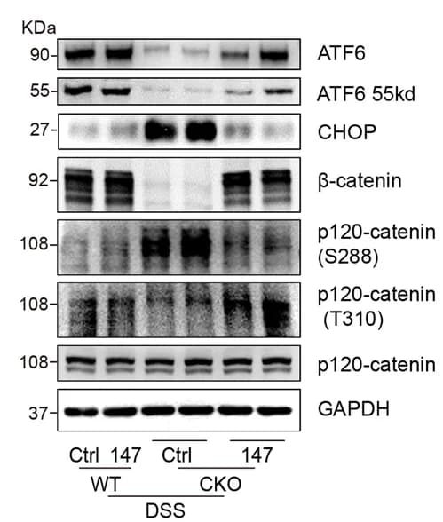 Open access visualization of Gel, Immunoblots, CHOP, Adherens Junctions, Pcdh20 CKO Mice