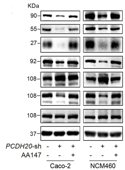 Open access visualization of Gel, PCDH20, CHOP, β-catenin, p-p120-catenin