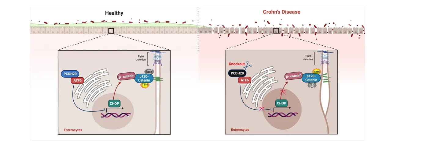 Open access visualization of Illustration, Workflow, Mechanism, PCDH20, Colitis