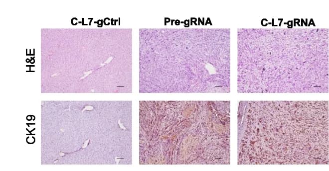 Open access visualization of Microscopy, H&E Staining, IHC Staining, Ck19, Mouse Liver Tumors
