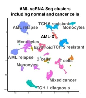 Open access visualization of UMAP, scRNA-seq, AML, Diagnostic biopsies, Relapse samples