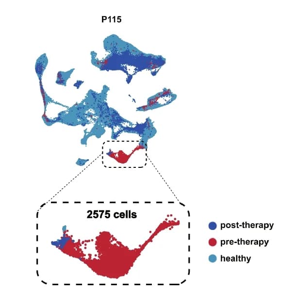 Open access visualization of Scatter Plot, UMAP, PCA, Healthy Donors, Pre-therapy Samples