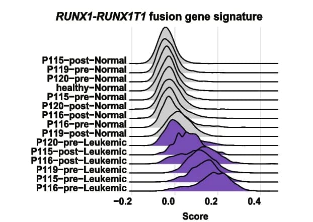 Open access visualization of Ridge Plot, Density Plot, Ridge Plots, RUNX1-RUNX1T1 Fusion Gene, Leukemic Cells