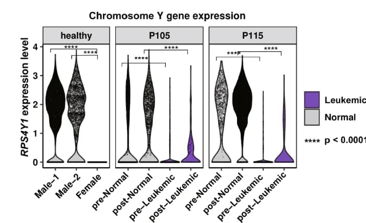 Open access visualization of Violin Plot, Violin Plots, RPS4Y1 Gene, Healthy Donors, Leukemic Cells