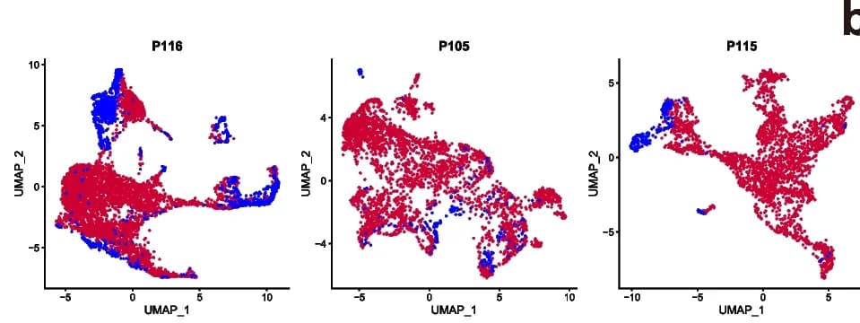 Open access visualization of Scatter Plot, UMAP, Leukemic Cells, Pre-therapy Samples, Post-therapy Samples