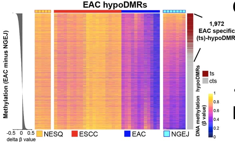 Open access visualization of Heatmap, Density Plot, DNA Methylation, EAC hypoDMRs, Heatmaps