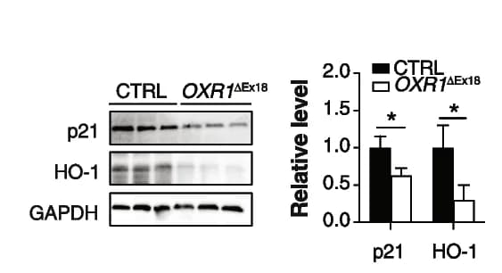Open access visualization of Bar Plot, Error Bars, Gel, Western Blot, p21