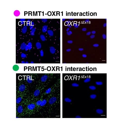 Open access visualization of Microscopy, Proximity Ligation Assay, OXR1, PRMT1, PRMT5