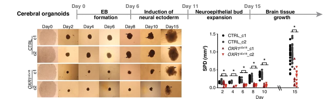 Open access visualization of Scatter Plot, Cerebral Organoids, Bright-Field Images, Neuroepithelial Formation, iPSC Clones