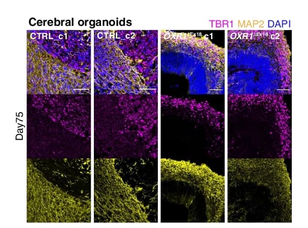 Open access visualization of Microscopy, Immunohistochemistry, Cerebral Organoids, Mature Neurons, Deep Layer Neurons