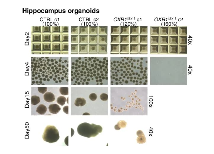 Open access visualization of Microscopy, Photo, Bright-Field Images, Hippocampus Organoids, Spheroids