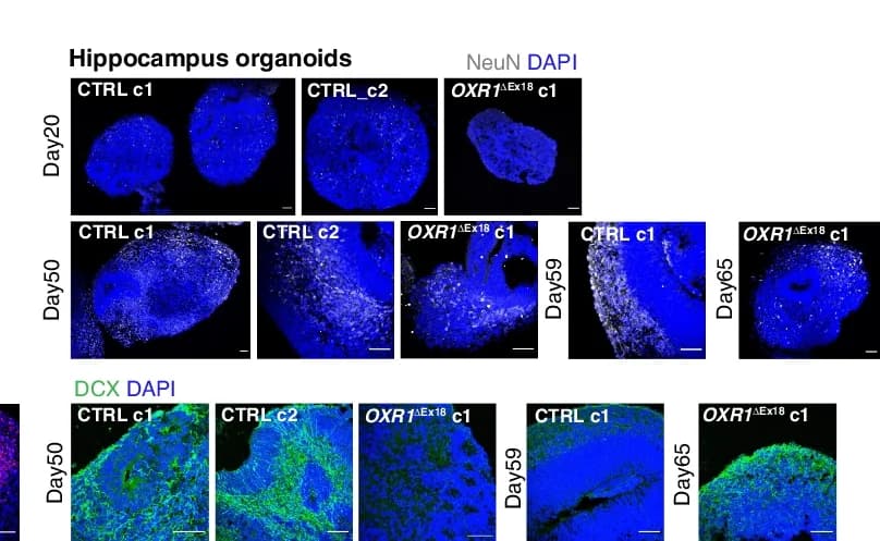 Open access visualization of Microscopy, Confocal Images, Hippocampus Organoids, NeuN+ Mature Neurons, DCX+ Immature Neurons
