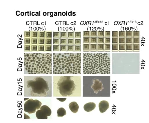 Open access visualization of Microscopy, Bright-field Images, Cortical Organoids, iPSCs, Cortical Patterning