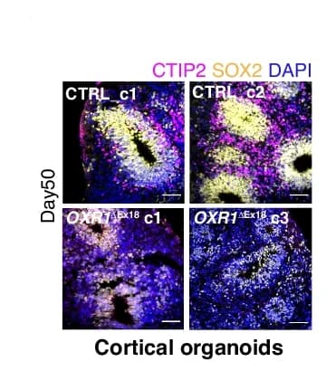 Open access visualization of Microscopy, Immunohistochemistry, CTIP2 Neurons, SOX2 Progenitor Zones, Cortical Organoids