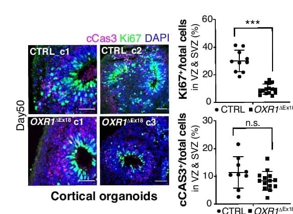 Open access visualization of Scatter Plot, Immunohistochemistry, Ki67 Proliferating Cells, cCas3 Apoptotic Cells, VZ/SVZ Progenitor Zones