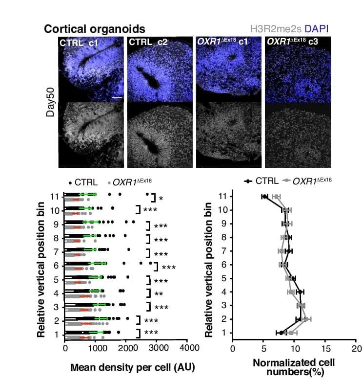 Open access visualization of Scatter Plot, Line Plot, Error Bars, Immunohistochemistry, H3R2me2s Cells