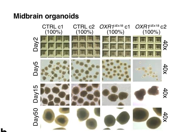 Open access visualization of Microscopy, Bright-field images, Midbrain Organoids, iPSCs, Midbrain Patterning
