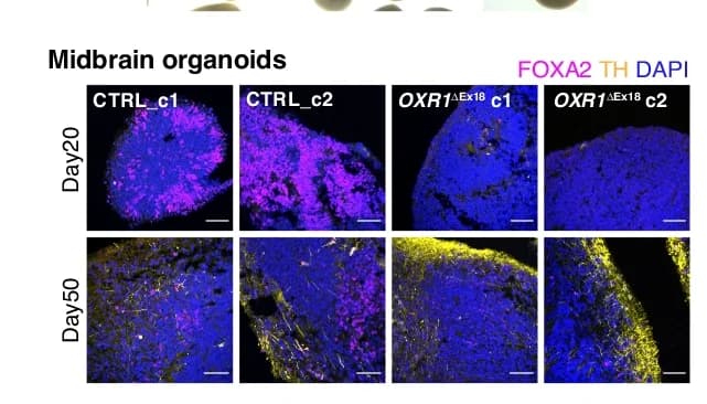 Open access visualization of Microscopy, Immunohistochemical Analyses, Midbrain Organoids, FOXA2, TH