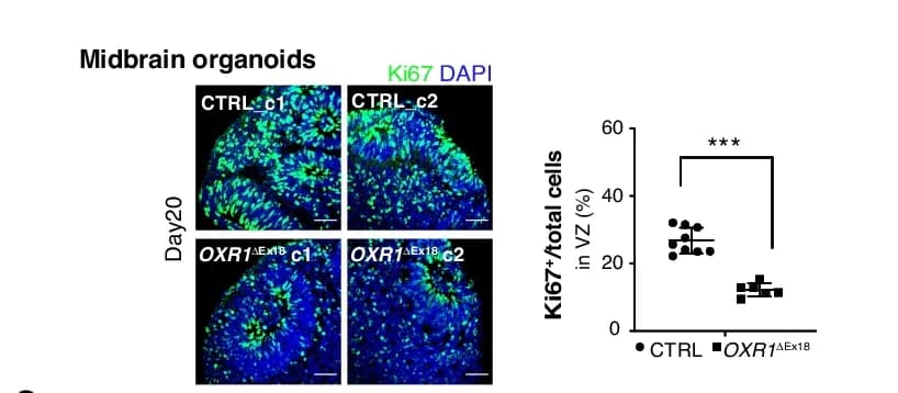 Open access visualization of Scatter Plot, Microscopy, Immunohistochemical Analyses, Ki67, Proliferating Cells