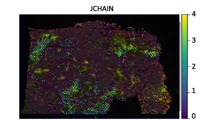 Open access visualization of Heatmap, JCHAIN, Spatial Variable Genes, FF Endometrial Adenocarcinoma Ovarian Tissue, Visium