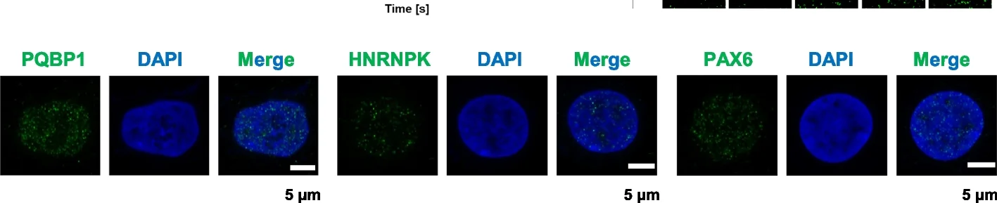 Open access visualization of Microscopy, Confocal Images, PQBP1, HNRNPK, PAX6