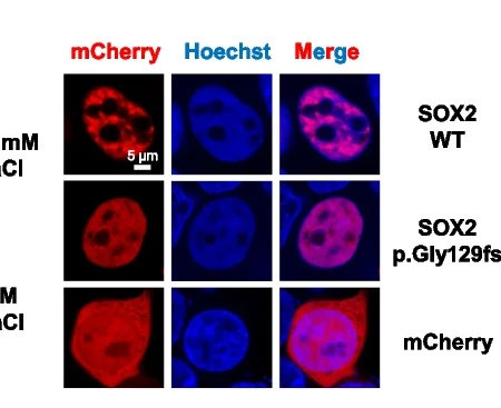 Open access visualization of Microscopy, Confocal Images, SOX2 Knockdown, HEK 293T Cells, mCherry