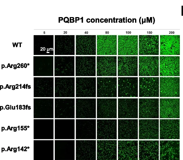 Open access visualization of Microscopy, Phase Diagram, PQBP1, NMD-Escaping Mutant Proteins, NaCl Concentration