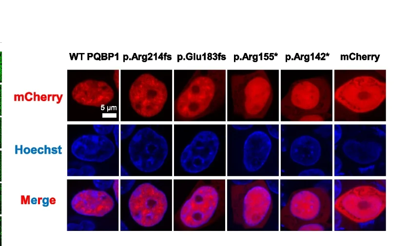 Open access visualization of Microscopy, Confocal Images, PQBP1 Knockout, HEK 293T Cells, mCherry