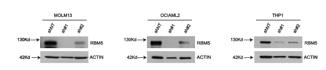 Open access visualization of Gel, Western Blot, RBM5 Expression, MOLM13 Cells, OCIAML2 Cells