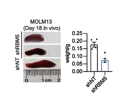 Open access visualization of Bar Plot, Error Bars, Photo, Mice Spleen, shNT