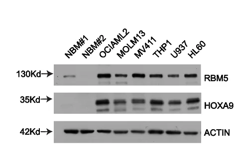 Open access visualization of Gel, Immunoblotting, RBM5, HOXA9, Leukemia Cell Lines