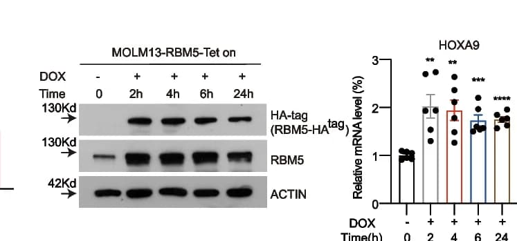 Open access visualization of Bar Plot, Error Bars, Gel, Doxycycline-Tet-On System, RBM5-HA Overexpression
