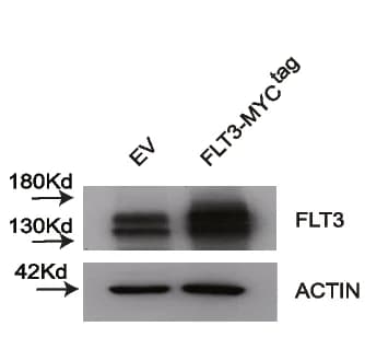 Open access visualization of Gel, Immunoblotting, OCIAML2 Cells, Venus Empty Vector, FLT3 cDNA